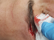 Corte boxeo ceja